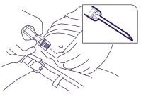 Disegno tecnico che mostra le mani che preparano un'iniezione