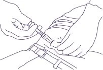 Disegno lineare di due mani che impugnano una siringa per iniettare un farmaco nella parte superiore della coscia di una persona con una fascia