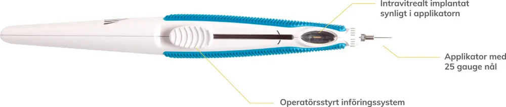 Iluvien 190 microgrammi impianto intravitreo in applicatore impianto intravitreo in applicatore