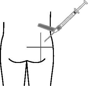 Dibujo esquemático de una jeringa que inserta el líquido
