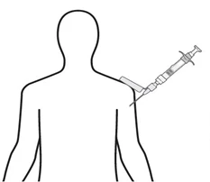 Dibujo esquemático de un torso humano visto desde atrás con una jeringa que inserta el líquido