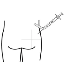 Dibujo esquemático de un torso humano visto desde atrás con una jeringa apuntando hacia la zona glútea marcada con una cruz negra