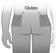 Diagrama médico que muestra la parte posterior de un cuerpo humano con dos áreas rectangulares resaltadas en los glúteos y la palabra «Glúteo»
