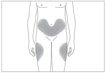 Schematic drawing of a human body showing gray areas on the