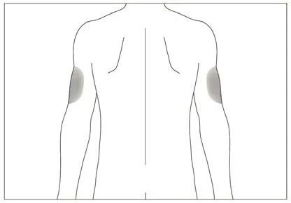 Linear diagram of a man's torso and arms viewed from the back with two gray areas indicating injection sites on the arms