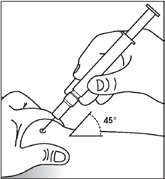 A hand holding a syringe to inject medication into subcutaneous tissue at a 45-degree angle to the skin