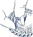 Technical drawing showing two hands lifting and stretching the skin to prepare the