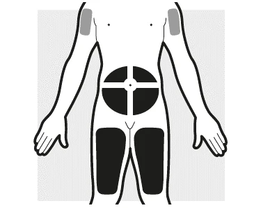 Diagrama del cuerpo humano con zonas grises en los brazos, un círculo negro dividido en cuatro en el abdomen y dos áreas negras en los muslos