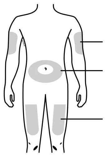 Esquema del cuerpo humano con áreas grises resaltadas en brazos, abdomen y muslos conectadas mediante líneas negras a espacios vacíos en el lado derecho