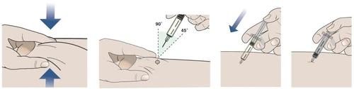 Secuencia de cuatro ilustraciones que muestran cómo preparar la piel e inyectar el medicamento con una aguja a 90 o 45 grados usando una jeringa