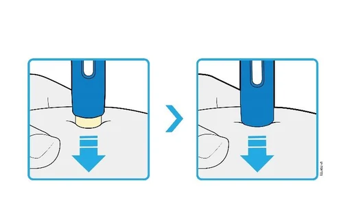 Two diagrams show a blue medical device being pressed vertically against the skin with an arrow pointing downward