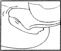 Dibujo esquemático en blanco y negro que muestra una sección anatómica de un miembro con líneas que delimitan músculos y tejidos subcutáneos