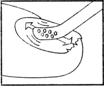 Dibujo esquemático que muestra un dispositivo médico con puntas circulares que se aplica sobre la piel con movimientos curvos indicados por flechas