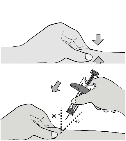 Medical illustration showing a hand pinching the skin and a