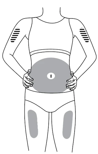 Esquema del cuerpo humano que indica las zonas de aplicación del medicamento en el