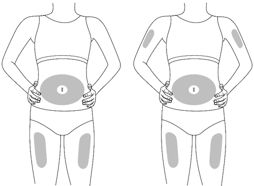 Dibujo de dos figuras humanas que muestran las zonas de aplicación del medicamento en el