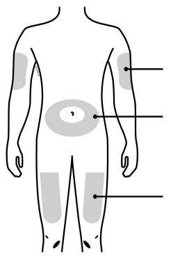 Diagrama del cuerpo humano con áreas grises resaltadas en brazos, abdomen y muslos conectadas por líneas negras a espacios vacíos a la derecha