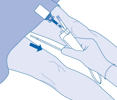 Medical illustration showing a gloved hand pressing an auto-injector device against the thigh with a blue downward arrow