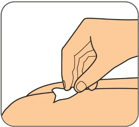 One hand gently pinches a skin fold on a limb to prepare the area for injection