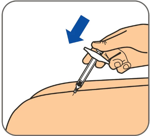 A hand holds a syringe with needle being inserted into the upper thigh following the direction of a blue arrow