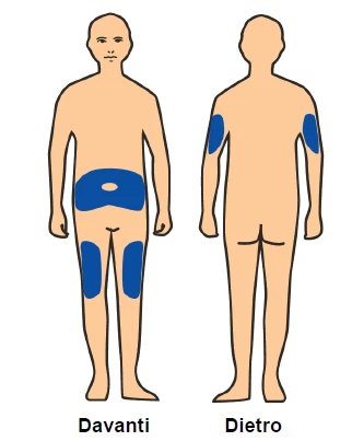 Diagram of a human body showing anterior and posterior views with highlighted blue areas on