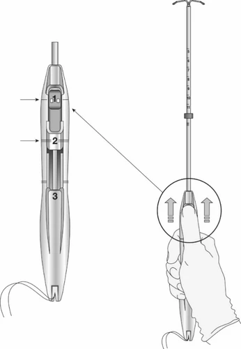 Technical diagram of a medical device with a lateral magnification indicating three components numbered 1, 2, and 3 and a hand holding it