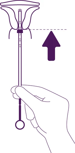 Medical illustration showing a hand lifting a plunger device toward the