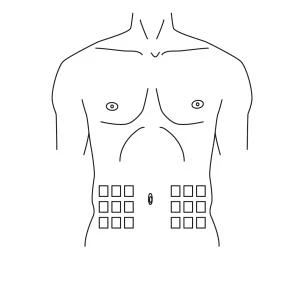 Schematic drawing of the male torso with two groups of nine small squares symmetrically arranged on the