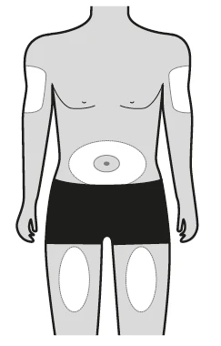 Diagram ciała mężczyzny wskazujący miejsca wstrzykiwań