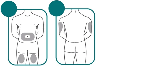 Diagramas esquemáticos de un cuerpo humano que muestran zonas de aplicación grises en el