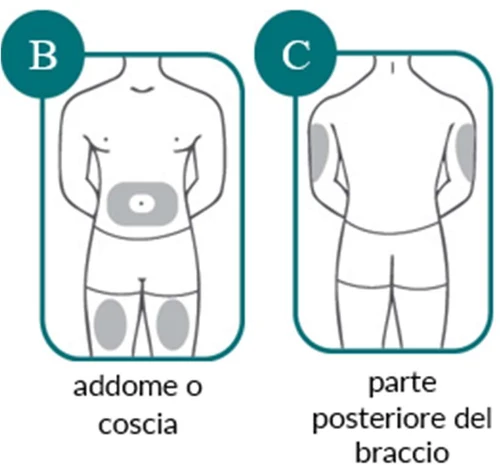 Diagramas médicos que muestran las zonas de inyección en el cuerpo: abdomen o muslo en la figura B y parte posterior del brazo en la figura C