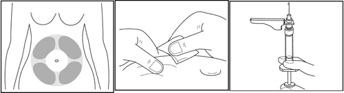Tres dibujos lineales muestran un torso con zonas de inyección, manos aplicando un parche y una mano sosteniendo un dispositivo médico tipo jeringa