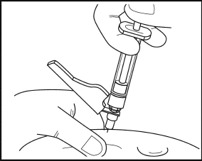 Una mano con guante sostiene una jeringa para inyectar el medicamento a través de la piel de una parte del cuerpo con el