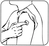 Una mano aplica un pequeño parche cuadrado en la parte superior del brazo de una persona con el dedo índice