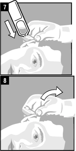Illustrazione in due fasi che mostra una mano che preme un dispositivo medico sulla fronte e poi lo solleva verso l'alto
