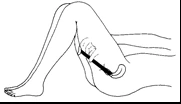 Line drawing of a bent leg with a syringe inserting the