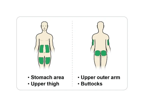 Diagrama de dos figuras humanas que indican las zonas de inyección: abdomen, parte superior del muslo, cara externa superior del brazo y glúteos
