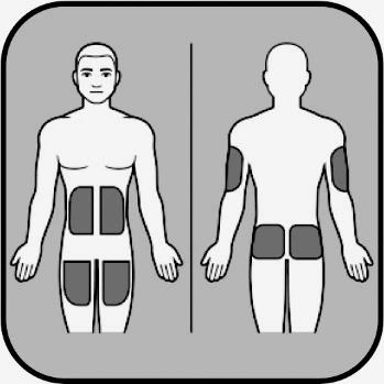 Diagrama médico que muestra la vista anterior y posterior de un cuerpo humano con cuatro áreas rectangulares oscuras resaltadas en el abdomen, muslos y brazos