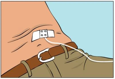 Una tirita médica aplicada sobre la