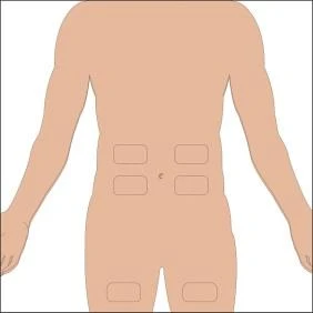 Illustration of the human torso with six dashed rectangular areas positioned on it