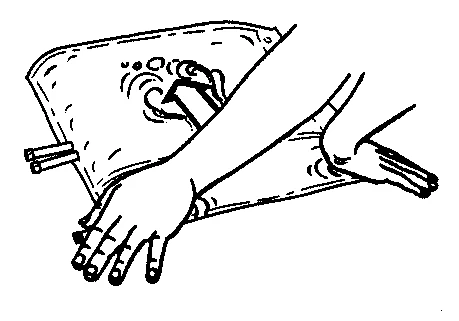 Black and white drawing showing two hands applying a dressing or bandage to a limb, with an arrow indicating movement