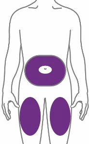 Diagram of the human body with three purple areas indicating application sites