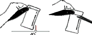 Dibujo esquemático que muestra dos manos sosteniendo un dispositivo médico para la