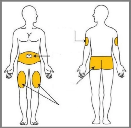 Diagram dwóch postaci ludzkich wskazujących żółte strefy aplikacji na