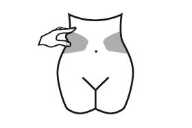 Dibujo estilizado de un torso femenino visto por detrás con una mano que pellizca la piel en la parte superior del glúteo izquierdo