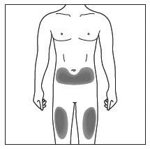 Dibujo esquemático de un torso masculino con áreas grises resaltadas en la zona abdominal inferior y en la parte superior de los muslos