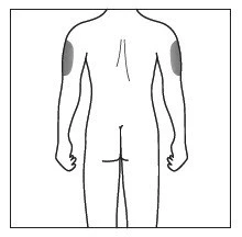 Dibujo esquemático de la espalda de un cuerpo humano con dos áreas grises resaltadas en la parte externa superior de ambos brazos