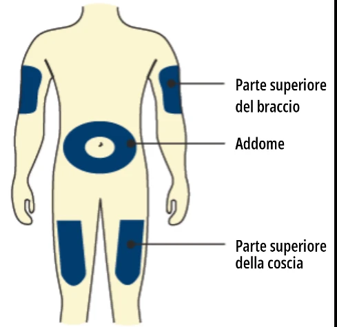 Human body diagram indicating injection sites: upper arm, abdomen, and upper thigh