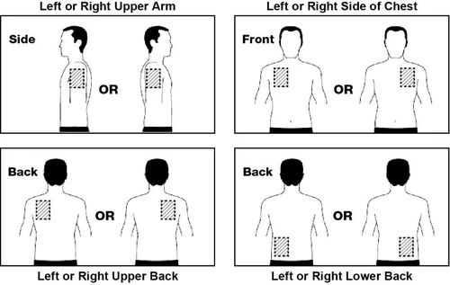 Schematic diagrams of human torsos showing injection sites on the arm, chest, upper and lower back, right or left side