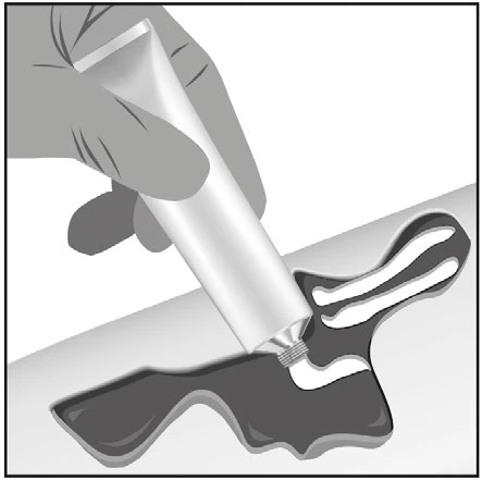A hand squeezing a tube of cream to apply the product onto an irritated and darkened skin area depicted in a schematic drawing